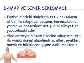 DAMAR VE SINIR SIKIŞMASI
 Kaslar içindeki sinirlerin tetik noktaların
etkisi ile sıkışması uyuşma, karıncalanma,
yanma ve hassasiyet artışı gibi şikayetler
yapabilmektedir.
 Yine arteryel sistem üzerine sıkıştırıcı etki
ile venöz dönüş alabilmekte, eller, ayaklar,
bacak ve bileklerde şişme olabilmektedir.
 