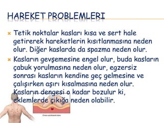 HAREKET PROBLEMLERI
 Tetik noktalar kasları kısa ve sert hale
getirerek hareketlerin kısıtlanmasına neden
olur. Diğer kaslarda da spazma neden olur.
 Kasların gevşemesine engel olur, buda kasların
çabuk yorulmasına neden olur, egzersiz
sonrası kasların kendine geç gelmesine ve
çalışırken aşırı kısalmasına neden olur.
Kasların dengesi o kadar bozulur ki,
eklemlerde çıkığa neden olabilir.
 