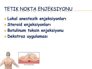 TETIK NOKTA ENJEKSIYONU
 Lokal anestezik enjeksiyonları
 Steroid enjeksiyonları
 Botulinum toksin enjeksiyonu
 Dekstroz uygulaması
 