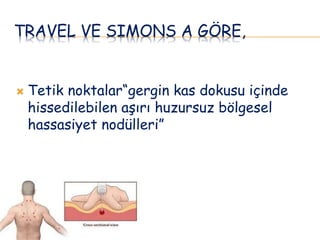 TRAVEL VE SIMONS A GÖRE,
 Tetik noktalar“gergin kas dokusu içinde
hissedilebilen aşırı huzursuz bölgesel
hassasiyet nodülleri”
 