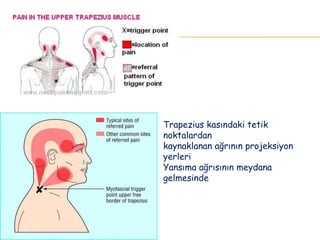 TRAPEZ
Trapezius kasındaki tetik
noktalardan
kaynaklanan ağrının projeksiyon
yerleri
Yansıma ağrısının meydana
gelmesinde
 