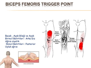 BICEPS FEMORIS TRIGGER POINT
Bacak , Ayak Bileği ve Ayak
Birincil Belirtileri : Arka Diz
Ağrısı siyatik
İkincil Belirtileri : Posterior
Uyluk ağrısı
 