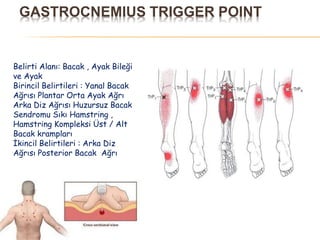 GASTROCNEMIUS TRIGGER POINT
Belirti Alanı: Bacak , Ayak Bileği
ve Ayak
Birincil Belirtileri : Yanal Bacak
Ağrısı Plantar Orta Ayak Ağrı
Arka Diz Ağrısı Huzursuz Bacak
Sendromu Sıkı Hamstring ,
Hamstring Kompleksi Üst / Alt
Bacak krampları
İkincil Belirtileri : Arka Diz
Ağrısı Posterior Bacak Ağrı
 