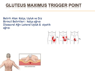 GLUTEUS MAXIMUS TRIGGER POINT
Belirti Alan: Kalça, Uyluk ve Diz
Birincil Belirtileri : kalça ağrısı
Iliosacral Ağrı Lateral Uyluk & siyatik
ağrısı
 