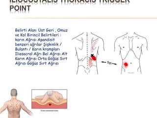ILIOCOSTALIS THORACIS TRIGGER
POINT
Belirti Alan: Üst Geri , Omuz
ve Kol Birincil Belirtileri :
karın Ağrısı Apandisit
benzeri ağrılar Şişkinlik /
Bulantı / Karın krampları
Iliosacral Ağrı Bel Ağrısı Alt
Karın Ağrısı Orta Göğüs Sırt
Ağrısı Göğüs Sırt Ağrısı
 