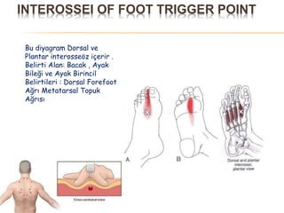 INTEROSSEI OF FOOT TRIGGER POINT
Bu diyagram Dorsal ve
Plantar interosseöz içerir .
Belirti Alan: Bacak , Ayak
Bileği ve Ayak Birincil
Belirtileri : Dorsal Forefoot
Ağrı Metatarsal Topuk
Ağrısı
 