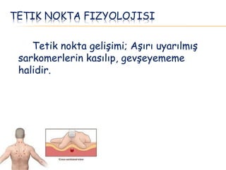 TETIK NOKTA FIZYOLOJISI
Tetik nokta gelişimi; Aşırı uyarılmış
sarkomerlerin kasılıp, gevşeyememe
halidir.
 