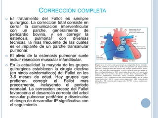 CORRECCIÓN COMPLETA





El tratamiento del Fallot es siempre
quirurgico. La correccion total consiste en
cerrar la comunicacion interventricular
con un parche, generalmente de
pericardio bovino, y en corregir la
estenosis
pulmonar
con
diversas
tecnicas, la mas frecuente de las cuales
es el implante de un parche transanular
pulmonar.
El alivio de la estenosis pulmonar suele
incluir reseccion muscular infundibular.
En la actualidad la mayoria de los grupos
quirurgicos establecen la cirugia electiva
(en ninos asintomaticos) del Fallot en los
3-6 meses de edad. Hay grupos que
prefieren
corregir
el
Fallot
mas
precozmente, incluyendo el periodo
neonatal. La correccion precoz del Fallot
favoreceria el desarrollo correcto del arbol
vascular pulmonar periférico y disminuiria
el riesgo de desarrollar IP significativa con
el seguimiento.

 