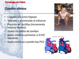 Tetralogía de Fallot


Cuadro clínico

• Cianosis y/o crisis hipoxia
• Tolerancia disminuida al esfuerzo
• Posición en cuclillas (incrementa
  retorno venoso)
• Dedos en palillo de tambor
• Soplo sistólico pulmonar o III EIC
  izquierdo
• Soplo continuo cuando hay PCA
 