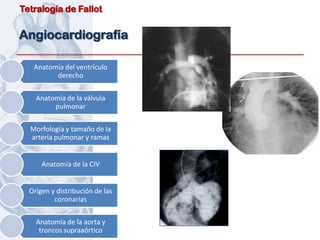 Tetralogía de Fallot


Angiocardiografía

   Anatomía del ventrículo
         derecho

    Anatomía de la válvula
         pulmonar

  Morfología y tamaño de la
  arteria pulmonar y ramas


      Anatomía de la CIV


  Origen y distribución de las
          coronarias

    Anatomía de la aorta y
     troncos supraaórtico
 