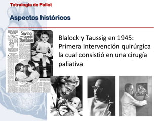 Tetralogía de Fallot


Aspectos históricos


                       Blalock y Taussig en 1945:
                       Primera intervención quirúrgica
                       la cual consistió en una cirugía
                       paliativa
 