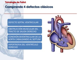 Tetralogía de Fallot

Comprende 4 defectos clásicos



   DEFECTO SEPTAL VENTRICULAR

   OBSTRUCCIÓN MUSCULAR DEL
   TRACTO DE SALIDA DERECHO

   CONEXIÓN BIVENTRICULAR DE LA
   AORTA CABALGANDO AL SEPTUM

   HIPERTROFIA DEL VENTRÍCULO
   DERECHO
 
