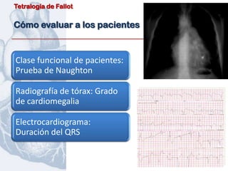 Tetralogía de Fallot


Cómo evaluar a los pacientes


Clase funcional de pacientes:
Prueba de Naughton

Radiografía de tórax: Grado
de cardiomegalia

Electrocardiograma:
Duración del QRS
 