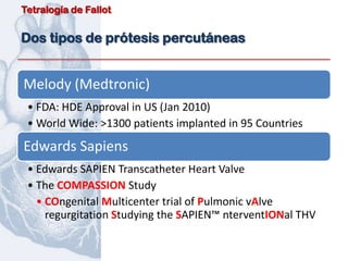 Tetralogía de Fallot


Dos tipos de prótesis percutáneas


Melody (Medtronic)
 • FDA: HDE Approval in US (Jan 2010)
 • World Wide: >1300 patients implanted in 95 Countries
Edwards Sapiens
 • Edwards SAPIEN Transcatheter Heart Valve
 • The COMPASSION Study
   • COngenital Multicenter trial of Pulmonic vAlve
     regurgitation Studying the SAPIEN™ nterventIONal THV
 