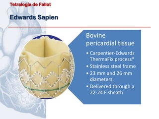 Tetralogía de Fallot


Edwards Sapien

                       Bovine
                       pericardial tissue
                       • Carpentier-Edwards
                         ThermaFix process*
                       • Stainless steel frame
                       • 23 mm and 26 mm
                         diameters
                       • Delivered through a
                         22-24 F sheath
 