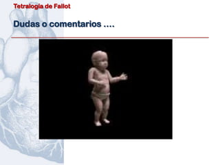 Tetralogía de Fallot


Dudas o comentarios ….
 