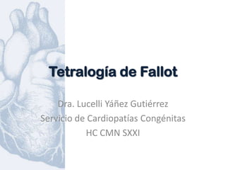 Tetralogía de Fallot

    Dra. Lucelli Yáñez Gutiérrez
Servicio de Cardiopatías Congénitas
           HC CMN SXXI
 