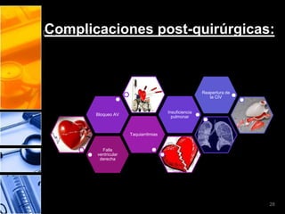 Complicaciones post-quirúrgicas:



                                                      Reapertura de
                                                         la CIV


                                      Insuficiencia
       Bloqueo AV                       pulmonar



                     Taquiarritmias


         Falla
       ventricular
        derecha




                                                                      28
 
