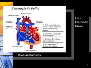 Leve
                   Intermedia
                   Grave




Datos anatómicos


                            5
 