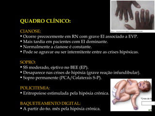 QUADRO CLÍNICO: CIANOSE: Ocorre precocemente em RN com grave EI associado a EVP. Mais tardia em pacientes com EI dominante. Normalmente a cianose é constante. Pode se agravar ou ser intermitente entre as crises hipóxicas. SOPRO: SS moderado, ejetivo no BEE (EP). Desaparece nas crises de hipóxia (grave reação infundibular). Sopro permanente (PCA/Colaterais S-P). POLICITEMIA: Eritropoiese estimulada pela hipóxia crônica. BAQUETEAMENTO DIGITAL: A partir do 6o. mês pela hipóxia crônica. 