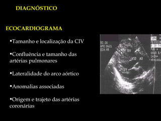 ECOCARDIOGRAMA Tamanho e localização da CIV Confluência e tamanho das  artérias pulmonares Lateralidade do arco aórtico Anomalias associadas Origem e trajeto das artérias coronárias DIAGNÓSTICO 