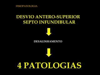 4 PATOLOGIAS DESVIO ANTERO-SUPERIOR  SEPTO INFUNDIBULAR DESALINHAMENTO FISIOPATOLOGIA 