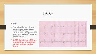 Rad Ecg Example TETRAjfkghkkhkhkgjffhhdhddhLOGY-OF-FALLOT.pptx