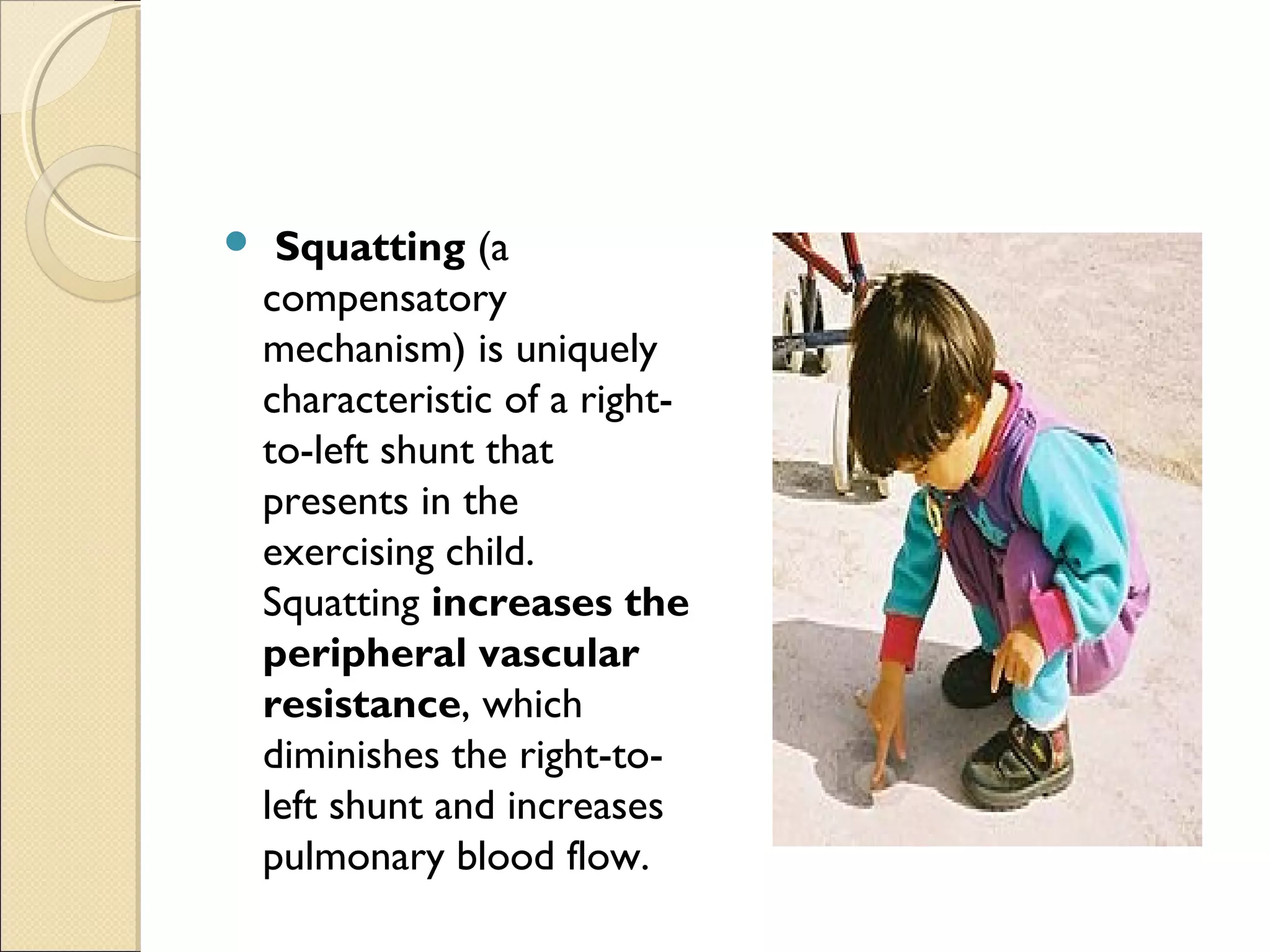 Tips On Understanding Fallouts Tetralogy of fallot | PPT