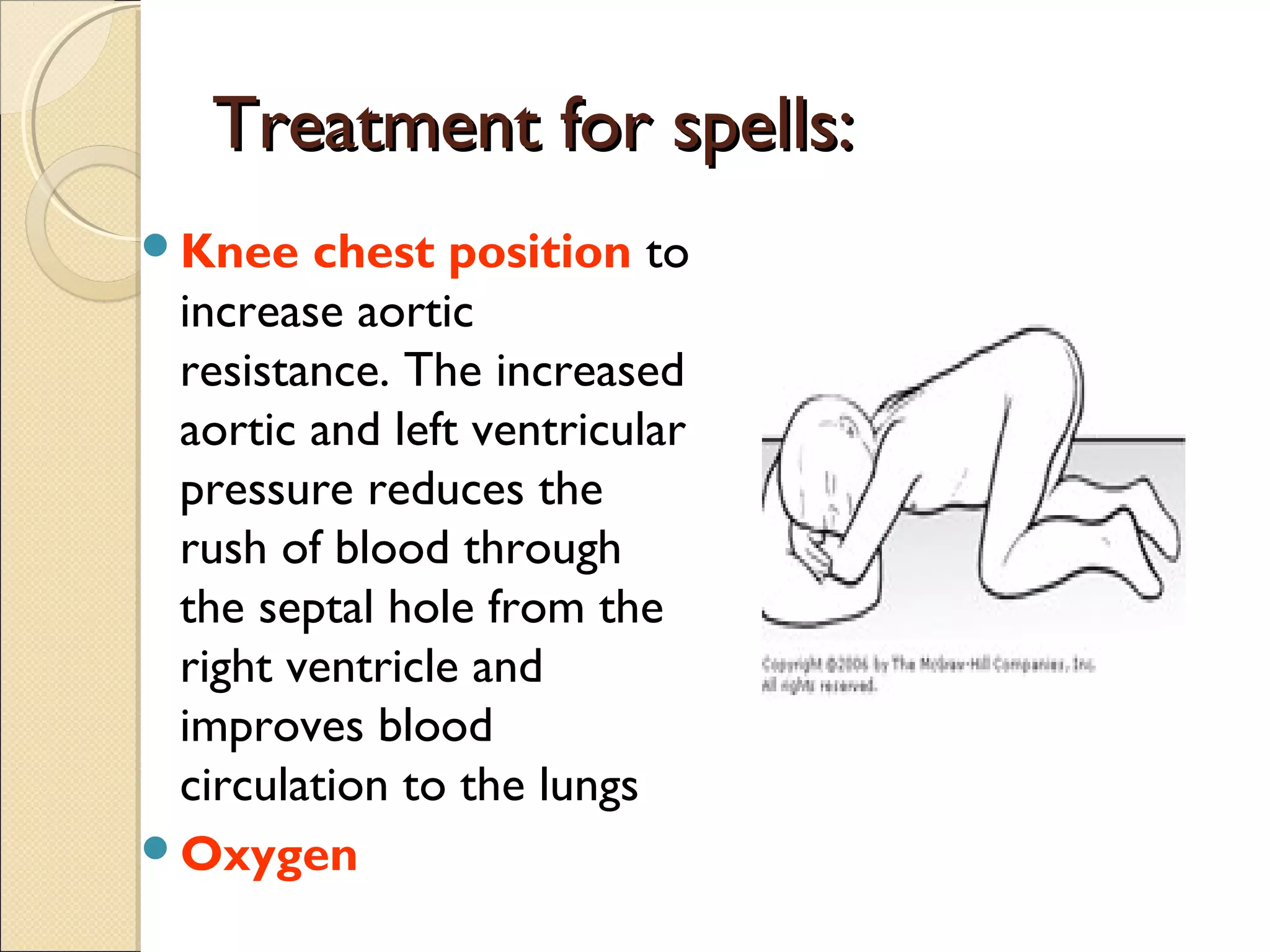 Tips On Understanding Fallouts Tetralogy of fallot | PPT