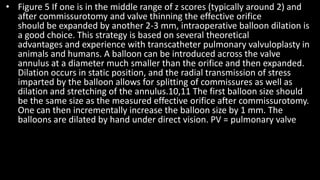 • Figure 5 If one is in the middle range of z scores (typically around 2) and
after commissurotomy and valve thinning the effective orifice
should be expanded by another 2-3 mm, intraoperative balloon dilation is
a good choice. This strategy is based on several theoretical
advantages and experience with transcatheter pulmonary valvuloplasty in
animals and humans. A balloon can be introduced across the valve
annulus at a diameter much smaller than the orifice and then expanded.
Dilation occurs in static position, and the radial transmission of stress
imparted by the balloon allows for splitting of commissures as well as
dilation and stretching of the annulus.10,11 The first balloon size should
be the same size as the measured effective orifice after commissurotomy.
One can then incrementally increase the balloon size by 1 mm. The
balloons are dilated by hand under direct vision. PV = pulmonary valve
 