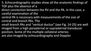 5. Echocardiographic studies show all the anatomic findings of
TOF plus the absence of a
direct connection between the RV and the PA. In this case, a
careful examination of the
central PA is necessary with measurements of the size of
central and branch PAs. The
small branch PAs and “vertical ductus” (see Fig. 14-25) are well
imaged from a high parasternal or suprasternal transducer
position. Some of the multiple collateral arteries
are also imaged by echocardiography and Doppler
 