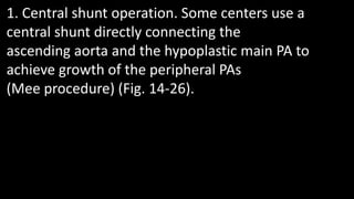 1. Central shunt operation. Some centers use a
central shunt directly connecting the
ascending aorta and the hypoplastic main PA to
achieve growth of the peripheral PAs
(Mee procedure) (Fig. 14-26).
 