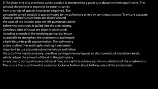 B The distal end of a prosthetic valved conduit is shortened to a point just above the heterograft valve. The
conduit shown here is meant to be generic; valves
from a variety of species have been employed. The
composite valved conduit is approximated to the pulmonary artery by continuous suture. To ensure accurate
closure, several suture loops are placed around
the apex of the incision onto the left pulmonary artery
before the prosthesis is pulled into the arteriotomy.
Generous bites of tissue are taken in each stitch,
including as much of the overlying pericardial tissue
as possible to strengthen the anastomosis and ensure
a tight tissue-to-graft approximation. The pulmonary
artery is often thin and fragile, making it extremely
important to use accurate suture technique and follow
the arc of the needle precisely. Low-flow cardiopulmonary bypass or short periods of circulatory arrest,
which reduce the amount of blood in the pulmonary
artery due to aortopulmonary collateral flow, are useful to achieve optimal visualization of the anastomosis.
The suture line is continued in a counterclockwise fashion about halfway around the anastomosis
 