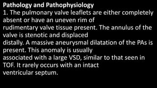Pathology and Pathophysiology
1. The pulmonary valve leaflets are either completely
absent or have an uneven rim of
rudimentary valve tissue present. The annulus of the
valve is stenotic and displaced
distally. A massive aneurysmal dilatation of the PAs is
present. This anomaly is usually
associated with a large VSD, similar to that seen in
TOF. It rarely occurs with an intact
ventricular septum.
 