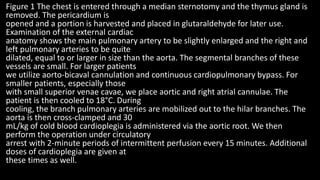 Figure 1 The chest is entered through a median sternotomy and the thymus gland is
removed. The pericardium is
opened and a portion is harvested and placed in glutaraldehyde for later use.
Examination of the external cardiac
anatomy shows the main pulmonary artery to be slightly enlarged and the right and
left pulmonary arteries to be quite
dilated, equal to or larger in size than the aorta. The segmental branches of these
vessels are small. For larger patients
we utilize aorto-bicaval cannulation and continuous cardiopulmonary bypass. For
smaller patients, especially those
with small superior venae cavae, we place aortic and right atrial cannulae. The
patient is then cooled to 18°C. During
cooling, the branch pulmonary arteries are mobilized out to the hilar branches. The
aorta is then cross-clamped and 30
mL/kg of cold blood cardioplegia is administered via the aortic root. We then
perform the operation under circulatory
arrest with 2-minute periods of intermittent perfusion every 15 minutes. Additional
doses of cardioplegia are given at
these times as well.
 