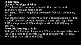 • Radiography
Cyanotic Tetralogy of Fallot
1. The heart size is normal or smaller than normal, and
pulmonary vascular markings are
decreased. “Black” lung fields are seen in TOF with pulmonary
atresia.
2. A concave main PA segment with an upturned apex (i.e., “boot-
shaped” heart or coeuren sabot) is characteristic (Fig. 14-19).
3. RA enlargement (25%) and right aortic arch (25%) may be
present.
Acyanotic Tetralogy of Fallot
Radiographic findings of acyanotic TOF are indistinguishable from
those of a small to moderate VSD (but patients with TOF have
RVH rather than LVH on the ECG).
 