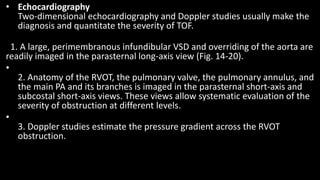 • Echocardiography
Two-dimensional echocardiography and Doppler studies usually make the
diagnosis and quantitate the severity of TOF.
1. A large, perimembranous infundibular VSD and overriding of the aorta are
readily imaged in the parasternal long-axis view (Fig. 14-20).
•
2. Anatomy of the RVOT, the pulmonary valve, the pulmonary annulus, and
the main PA and its branches is imaged in the parasternal short-axis and
subcostal short-axis views. These views allow systematic evaluation of the
severity of obstruction at different levels.
•
3. Doppler studies estimate the pressure gradient across the RVOT
obstruction.
 
