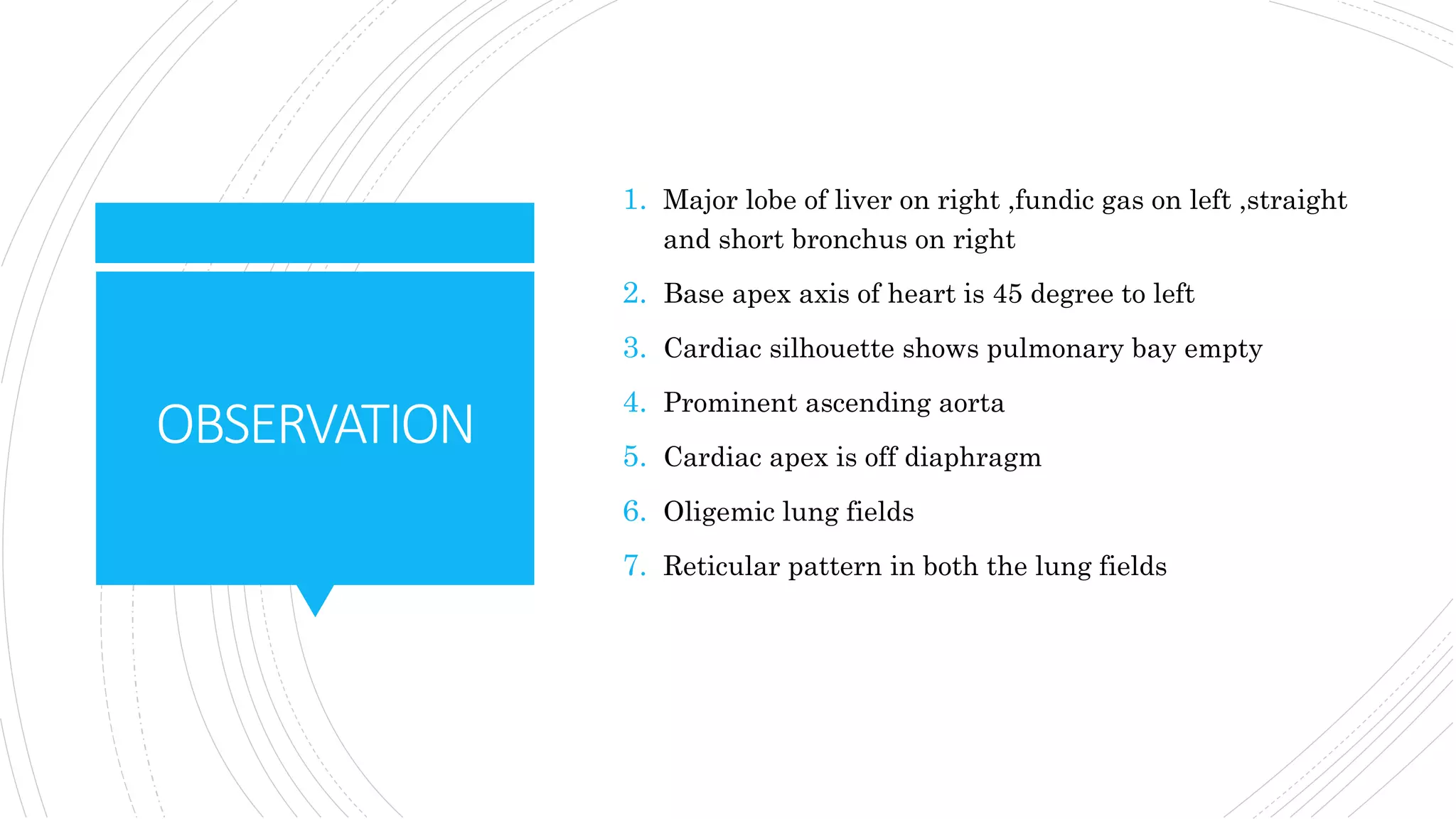 Tetralogy of fallot with pulmonary atresia | PPTX