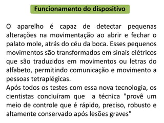 Funcionamento do dispositivo

O aparelho é capaz de detectar pequenas
alterações na movimentação ao abrir e fechar o
palato mole, atrás do céu da boca. Esses pequenos
movimentos são transformados em sinais elétricos
que são traduzidos em movimentos ou letras do
alfabeto, permitindo comunicação e movimento a
pessoas tetraplégicas.
Após todos os testes com essa nova tecnologia, os
cientistas concluíram que a técnica "provê um
meio de controle que é rápido, preciso, robusto e
altamente conservado após lesões graves"
 