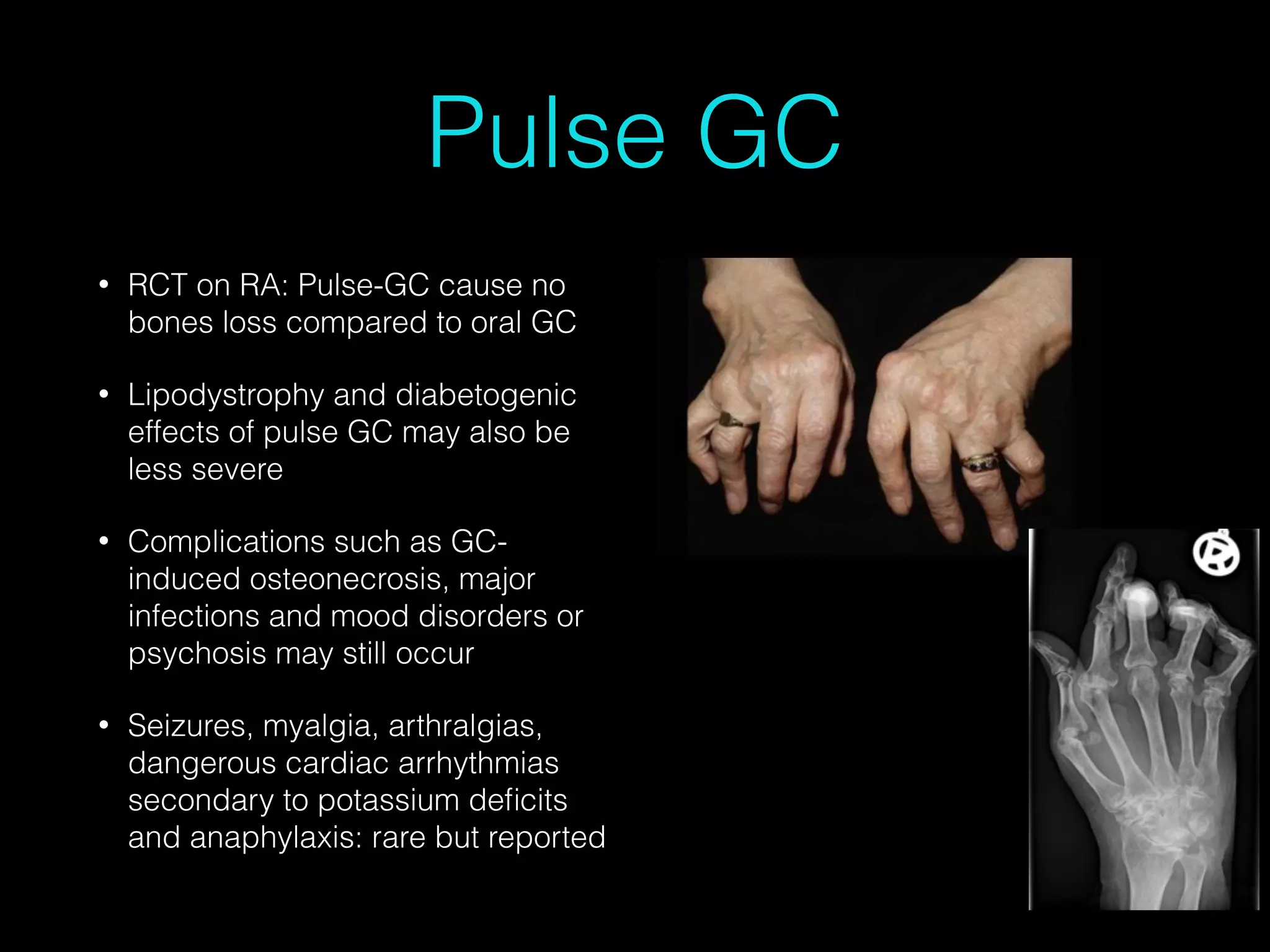 Methyprednisolone Pulse Therapy for Nurses | PDF