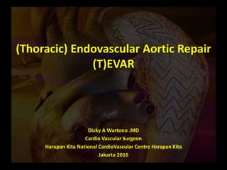 (Thoracic) Endovascular Aortic Repair
(T)EVAR
Dicky A Wartono .MD
Cardio Vascular Surgeon
Harapan Kita National CardioVascular Centre Harapan Kita
Jakarta 2016
 