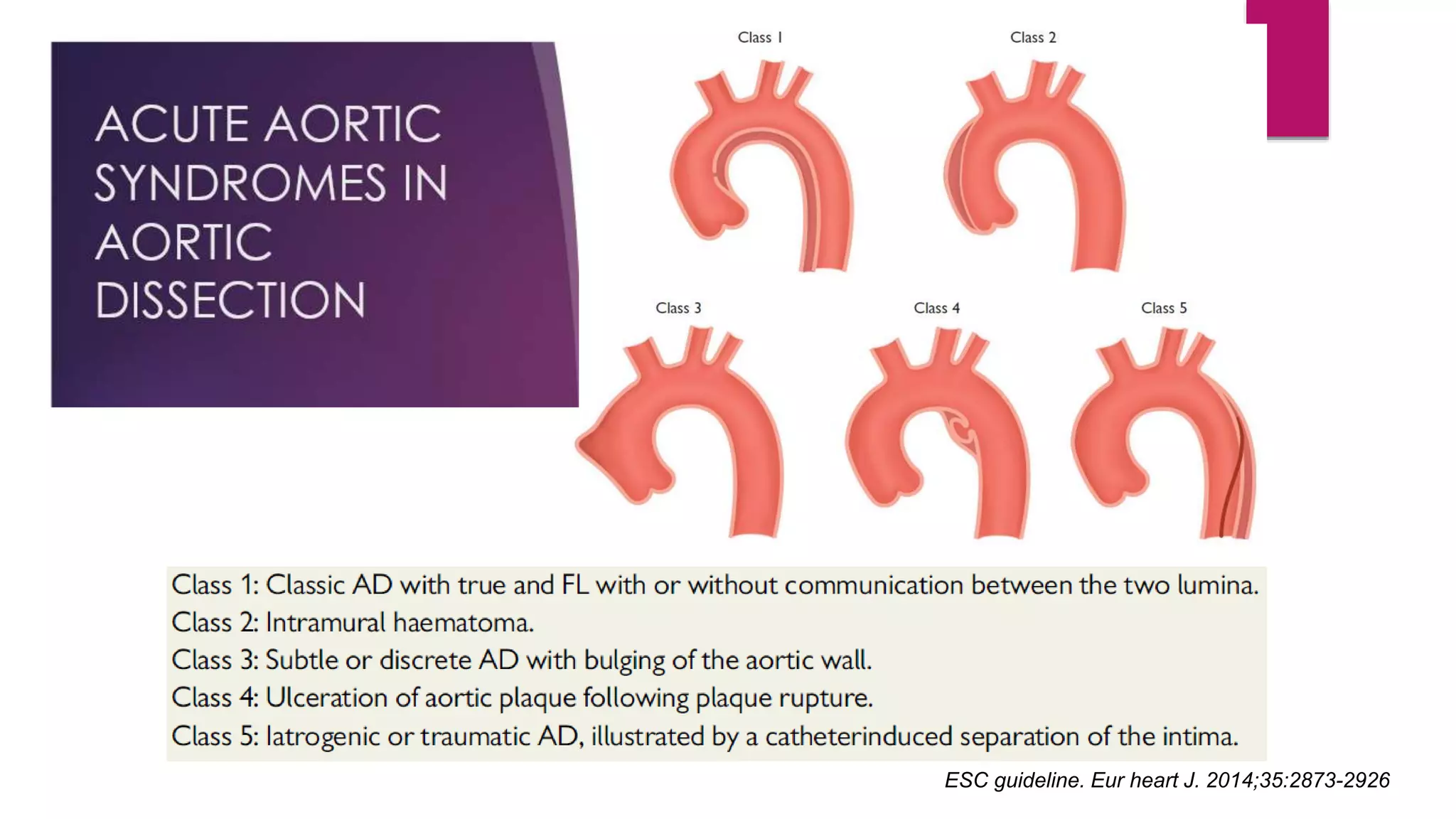 ESC guideline. Eur heart J. 2014;35:2873-2926
 