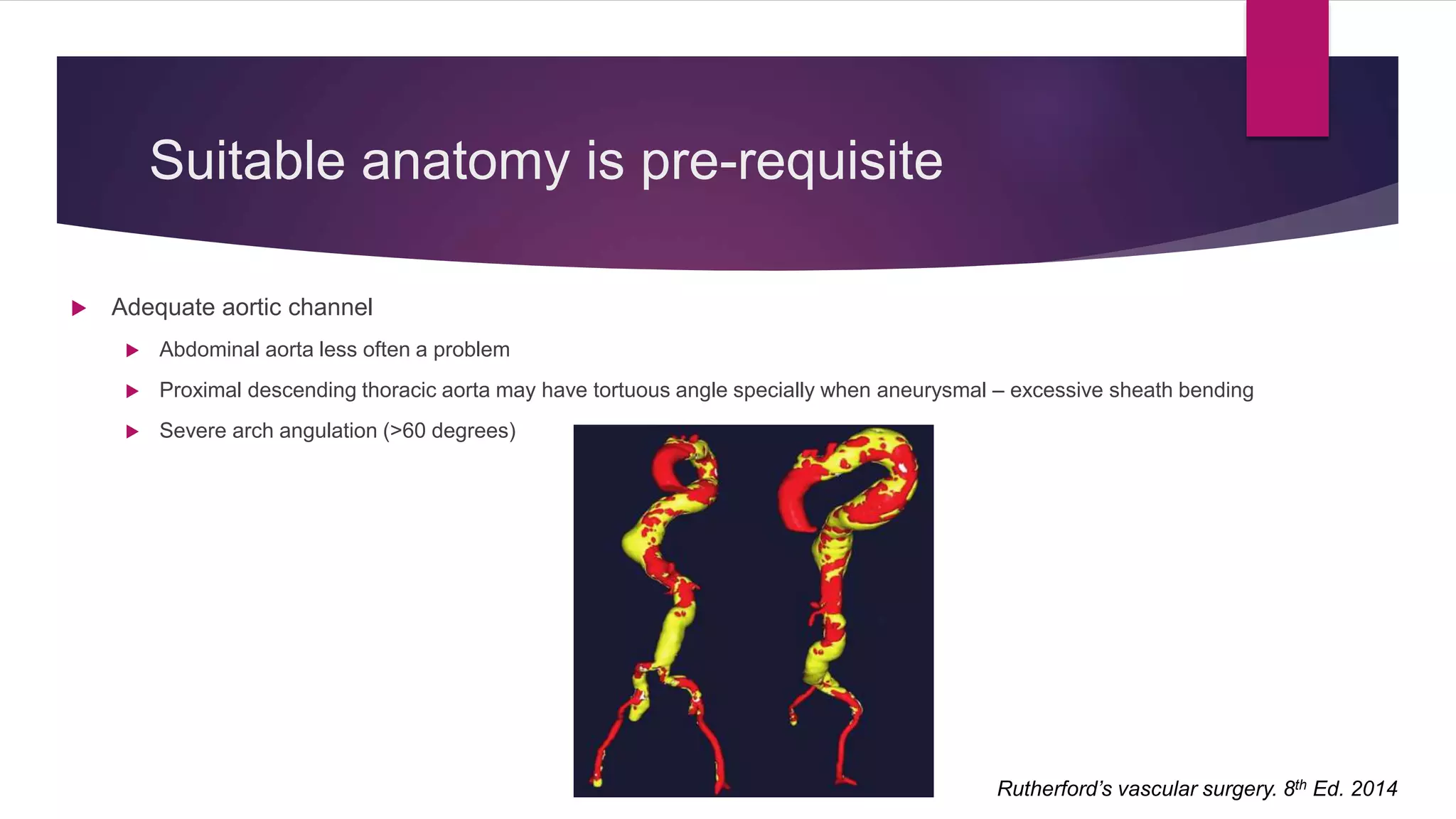 Suitable anatomy is pre-requisite
 Adequate aortic channel
 Abdominal aorta less often a problem
 Proximal descending thoracic aorta may have tortuous angle specially when aneurysmal – excessive sheath bending
 Severe arch angulation (>60 degrees)
Rutherford’s vascular surgery. 8th Ed. 2014
 