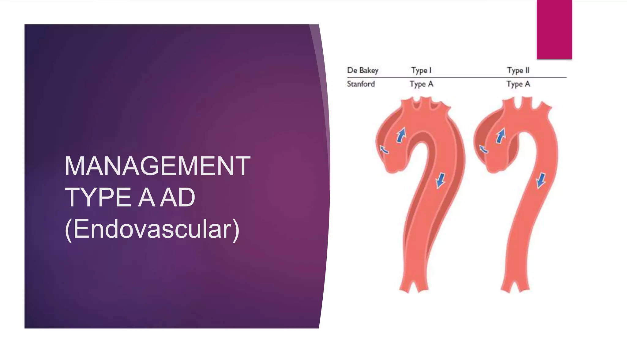 MANAGEMENT
TYPE A AD
(Endovascular)
 