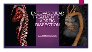 ENDOVASCULAR
TREATMENT OF
AORTIC
DISSECTION
SATYAM RAJVANSHI
 