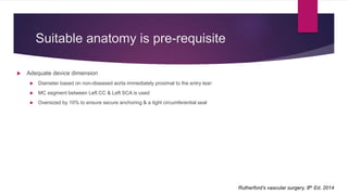 Endovascular management of Aortic Dissection | PPTX