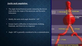 • The angle formed between points connecting the lowest
renal artery, the origin of the aneurysm, and the aortic
bifurcation
• Ideally, the aortic neck angle should be < 600
• Greater lead to difficulties in Implantation, Kinking,
Endoleak, and Distal device migration
• Angle >600 is generally considered to be a contraindication
Aortic neck angulation
 