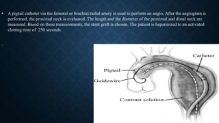 • A pigtail catheter via the femoral or brachial/radial artery is used to perform an angio, After the angiogram is
performed, the proximal neck is evaluated. The length and the diameter of the proximal and distal neck are
measured. Based on these measurements, the stent graft is chosen. The patient is heparinized to an activated
clotting time of 250 seconds.
.
 