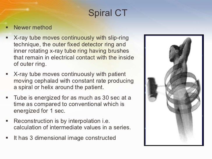 CT Scanner Solution
