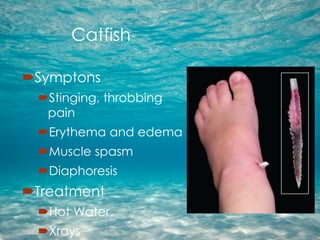 Marine Injuries TexMed 2014 | PPTX